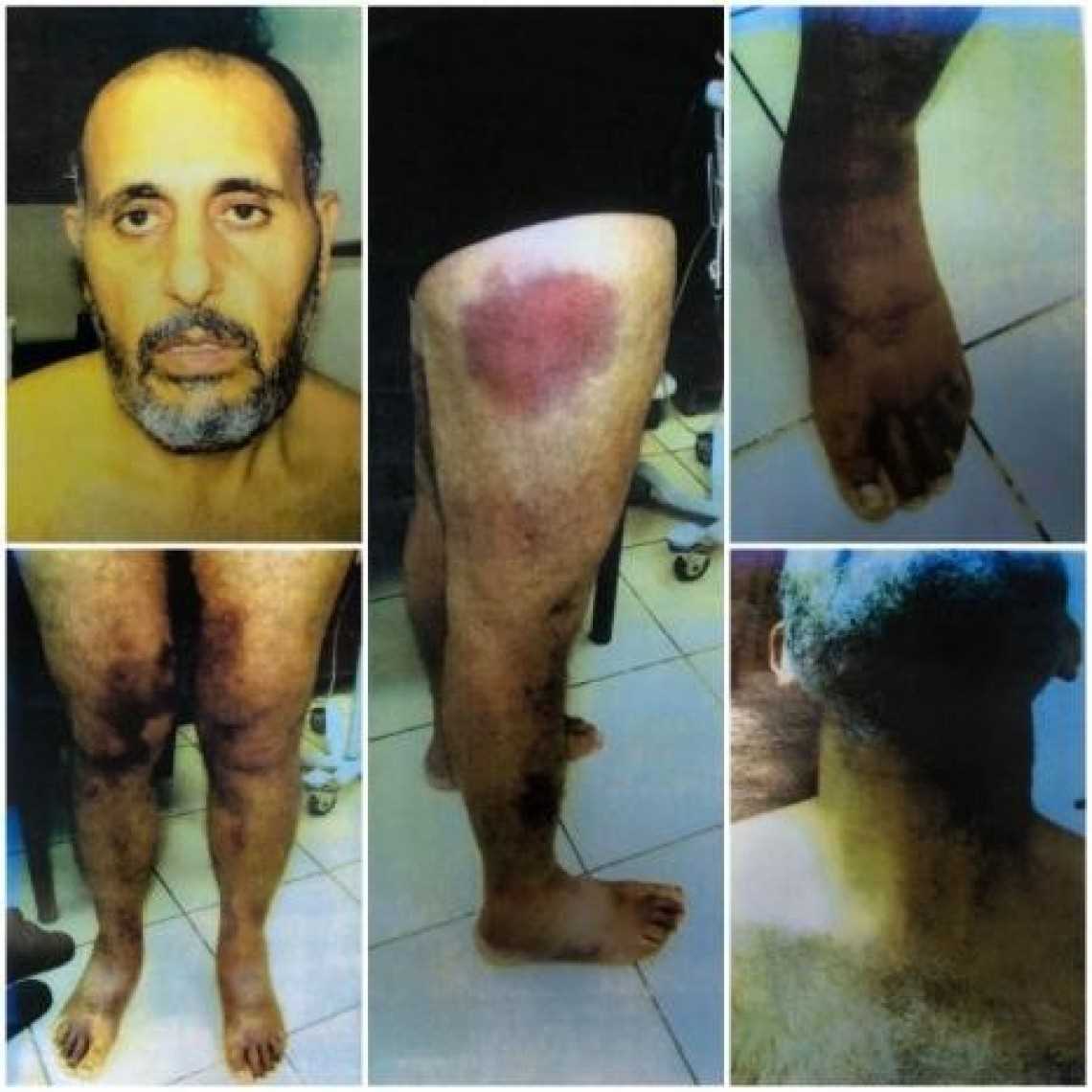 Tahanan Palestina Ini Terpaksa Hidup Diatas Atas Kursi Roda Setelah Mengalami  Siksaan Fisik Berat  di Penjara Israel