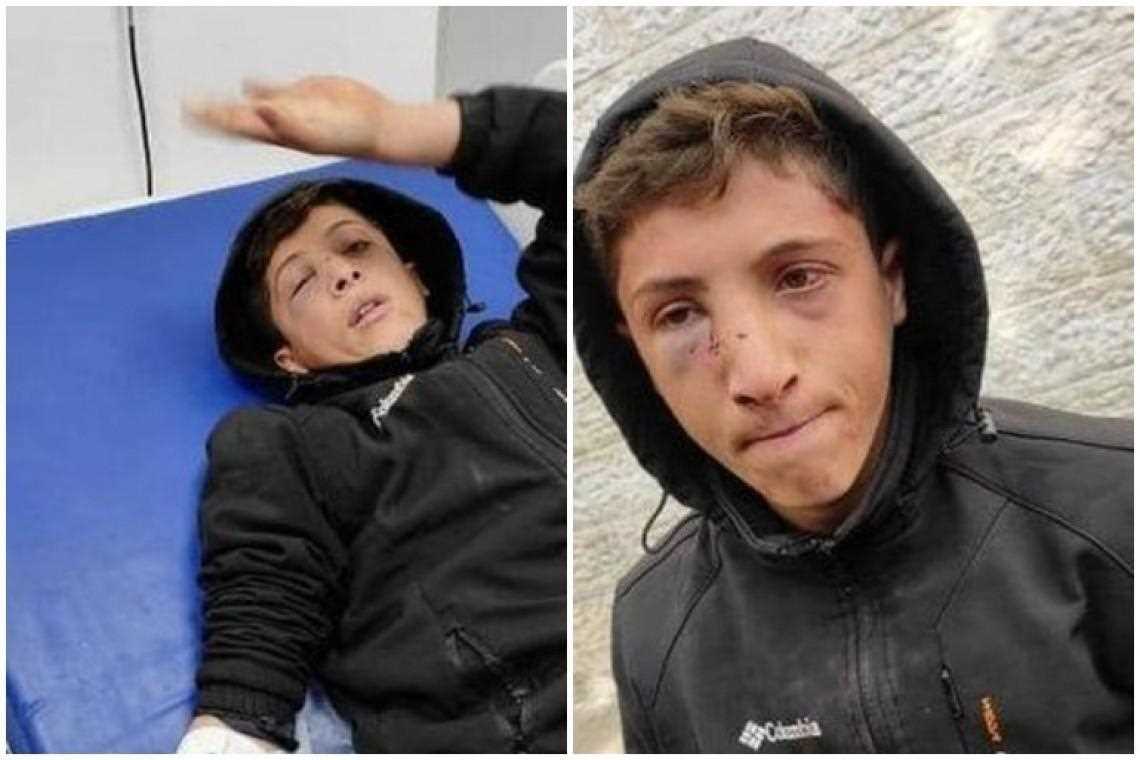 Israel Serang Anak Palestina di Al-Bireh