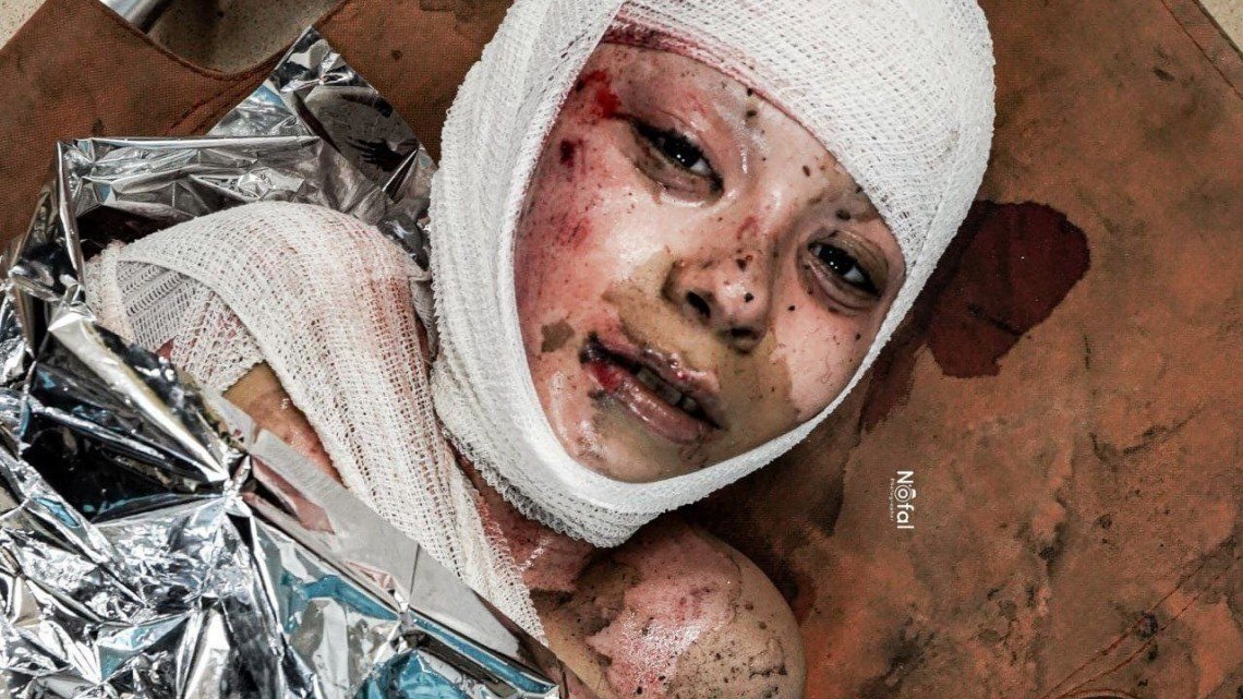 Kejahatan Kemanusiaan di Gaza: 320 Warga Sipil Jadi Korban Senjata Terlarang Buatan Amerika Serikat