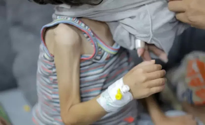 Blokade Israel: Pembunuh Pelan Tapi Pasti, 66.000 Anak Gaza Terancam Kelaparan