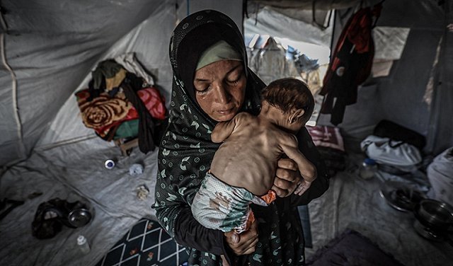 Air Tercemar dan Lapar Membunuh: Polio dan Malnutrisi Serang Anak-Anak Gaza