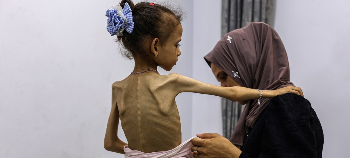 Krisis Terus Memburuk: 6 Penduduk Palestina di Gaza Meninggal Lagi Akibat Kelaparan